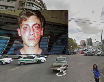 Un joven sufrió una brutal golpiza en una cervecería de La Plata