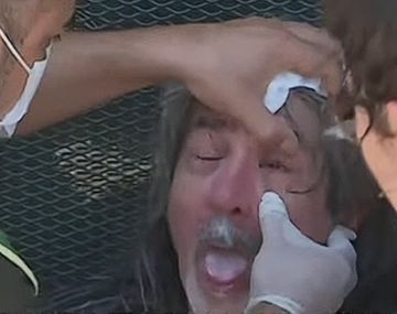 Un jubilado fue ferozmente atacado con gas pimienta en medio de la marcha en Congreso