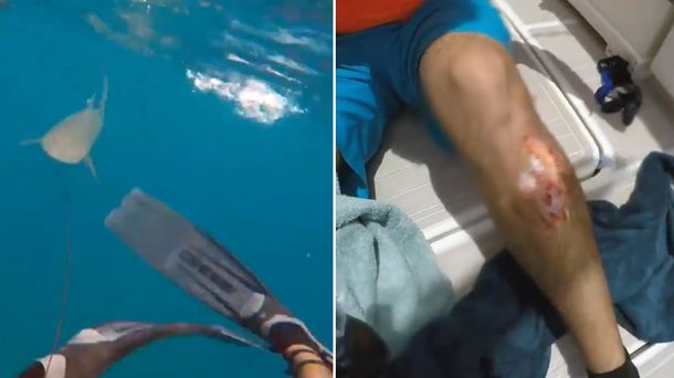 Un hombre sufrió el ataque de un tiburón en Key West