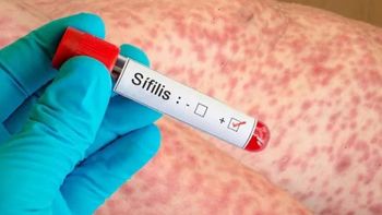 alerta sanitaria: la sifilis supero los 55 mil casos en el ultimo ano en argentina alerta sanitaria: la sifilis supero los 55 mil casos en el ultimo ano en argentina