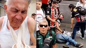 hablo el jubilado al que la policia de bullrich le quebro un brazo en la represion en congreso hablo el jubilado al que la policia de bullrich le quebro un brazo en la represion en congreso