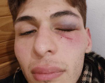 Brutal golpiza a una persona no binaria y con síndrome de Asperger