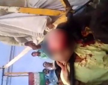 La adolescente perdió todo su pelo mientras se  sacaba una selfie en un parque de atracciones.