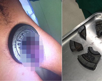 Metió su pene en una pesa