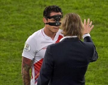 El mensaje de Lapadura para Gareca. 