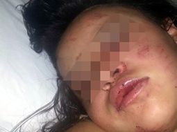 embarazada denuncio una golpiza de su ex embarazada denuncio una golpiza de su ex