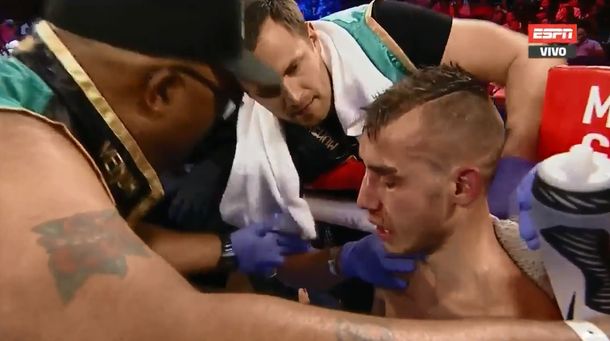 Murió el boxeador ruso Maxim Dadashev: el pedido de su entrenador para parar la pelea