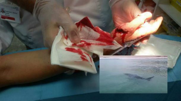 Cierran una playa en España por el ataque de un tiburón