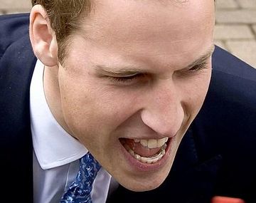Principe sin pelo
