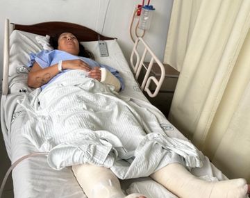 Turista argentina cayó desde un tercer piso en México: tramitan su repatriación