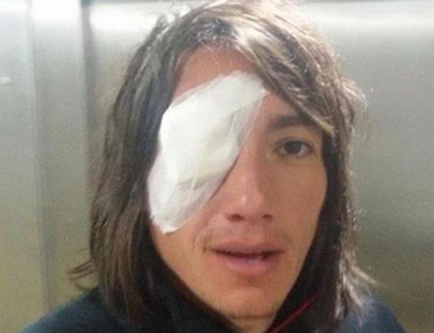 Habló Lugüercio tras la agresión: Me dan ganas de no jugar más