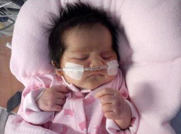 Piden donaciones para una beba que nació con una grave malformación congénita