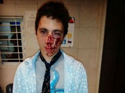 Bautista Beco mostró cómo quedó tras ser golpeado por una patota a la salida de un boliche Bautista Beco mostró cómo quedó tras ser golpeado por una patota a la salida de un boliche