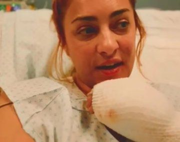 María Julia Oliván está fuera de peligro tras quemarse el 25% del cuerpo: Zafé