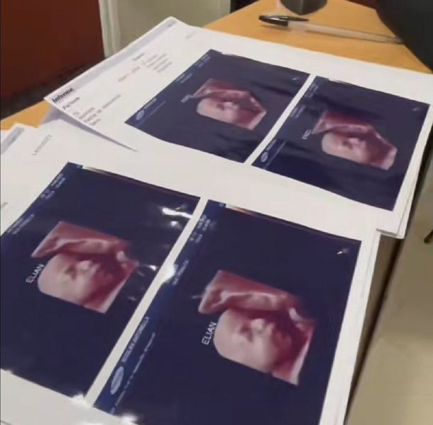 Denuncian que una clínica de ecografías 5D da las mismas fotos a todas las embarazadas