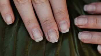 La vitamina C del limón ayuda mejorar tus uñas y tenerlas sanas y fuertes. La vitamina C del limón ayuda mejorar tus uñas y tenerlas sanas y fuertes.