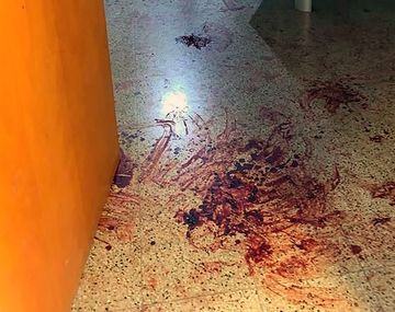Sigue el misterio en la Universidad de Córdoba por la sangre hallada en los baños