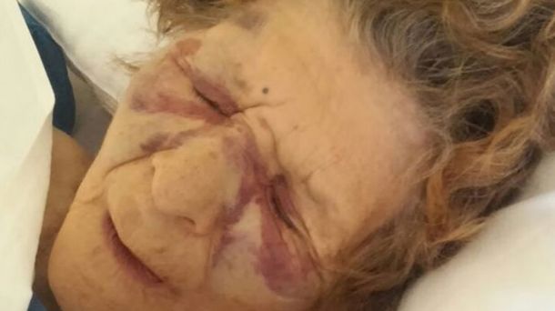 Brutal golpiza de dos bestias a una anciana: le pegaron hasta con un rebenque