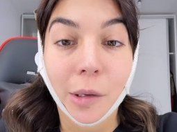 La preocupación de Luciana Milessi tras quedar con parálisis facial
