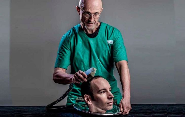 ¿Es posible? Realizan el primer trasplante de cabeza humana