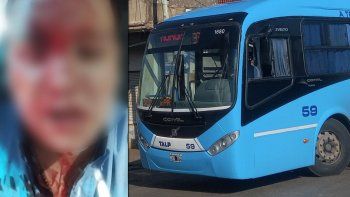 brutal ataque en un colectivo: un pasajero le partio una botella en la cabeza al chofer