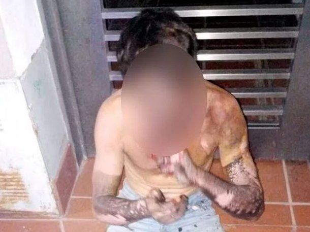 Otra vez: se electrocutó un ladrón al intentar robar cables en Rosario