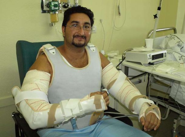 A casa: le dieron el alta al segundo hombre con  trasplante de sus brazos