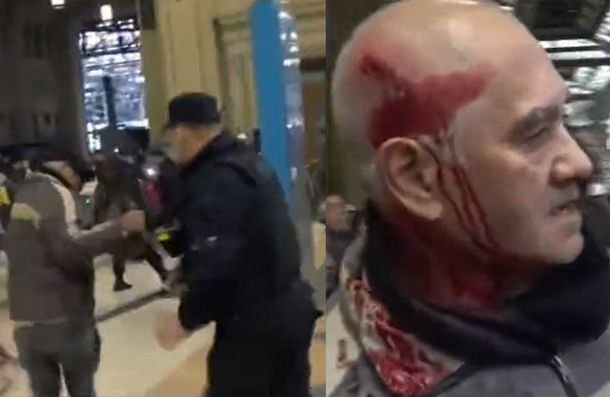 Constitución: usuario fue violentamente golpeado por un efectivo policial