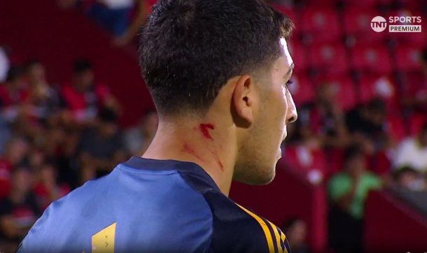 Agredieron a Leandro Brey.