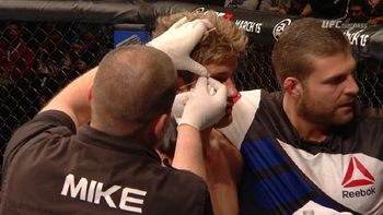 los lindos tambien caen: el sex symbol de la ufc perdio su invicto los lindos tambien caen: el sex symbol de la ufc perdio su invicto