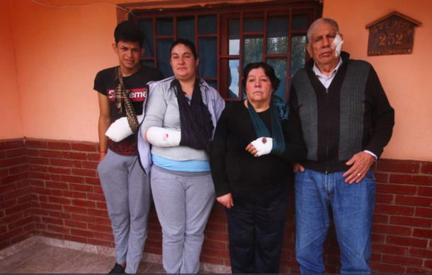 La familia atacada por el dogo en Córdoba