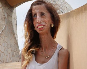 Estrenan el documental de Lizzie Velasquez