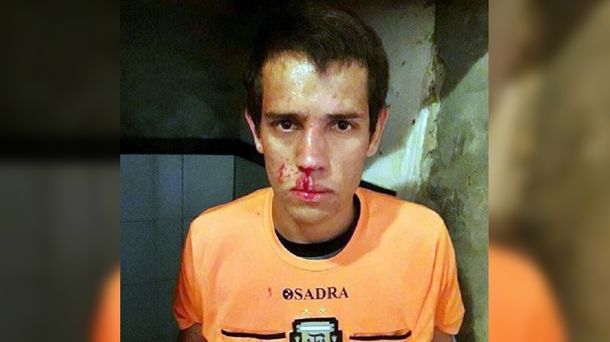 VIDEO: Un futbolista se enojó con el árbitro y le rompió la cara con un cabezazo