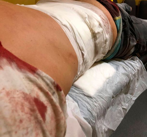 Fue a un boliche de la Costanera y patovicas lo golpearon y apuñalaron