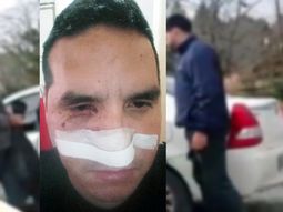 El policía herido tras el operativo en la casa de Jorge Castillo