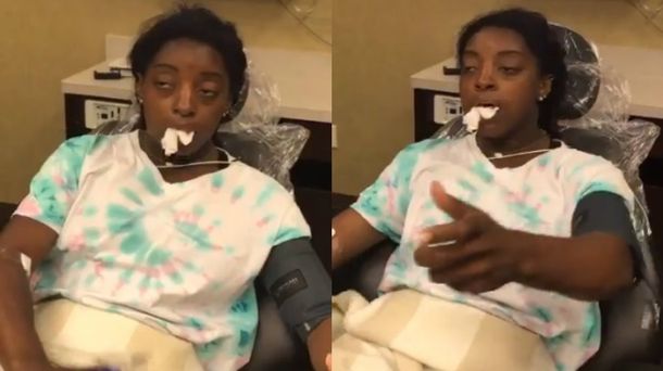 Simone Biles mostró su costado histriónico bajo el efecto de la anestesia