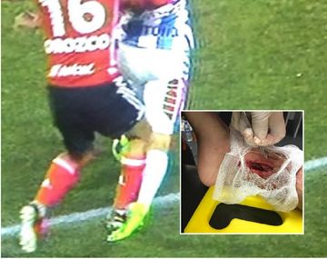 El momento del pisotón y el maltrecho tobillo de Lozano