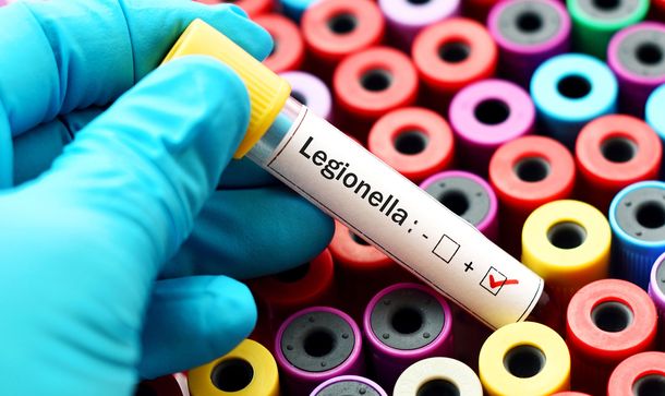 Qué es la Legionella