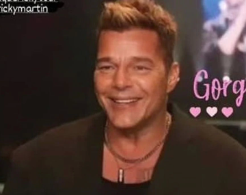 Ricky Martin aclaró qué fue lo que pasó con su nuevo rostro