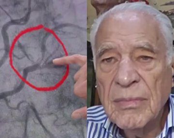 Cormillot contó el susto que vivió por un dolor en el pecho: qué fue lo que pasó