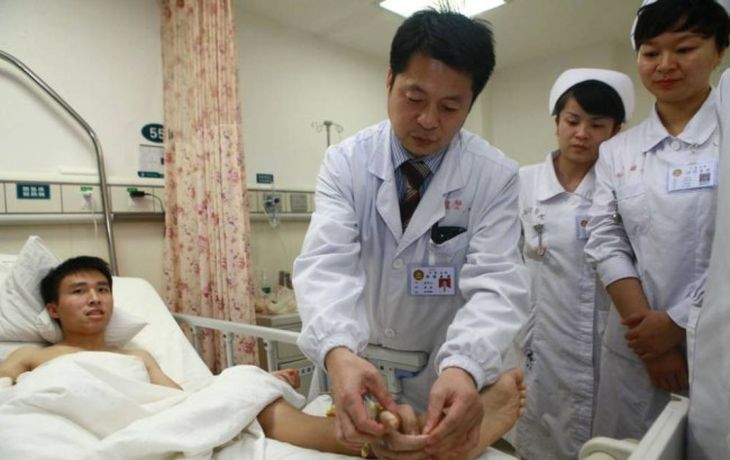 Le implantan su mano en el pie para salvarle la extremidad