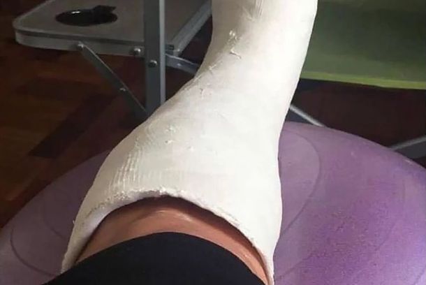 ¿Venden un yeso trucho para no ir a trabajar y ver el Mundial?