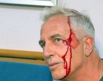 Marley se accidentó en Tailandia y terminó cubierto de sangre: qué le pasó