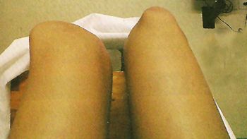 Rodilla.jpg Rodilla.jpg