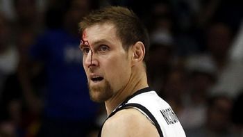 un guerrero: nocioni sufrio un terrible codazo y siguio jugando un guerrero: nocioni sufrio un terrible codazo y siguio jugando