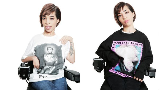 Una modelo con distrofia muscular es la cara de la nueva colección de Beyoncé