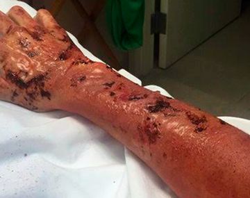 Impresionante foto de la mano de Juana Viale