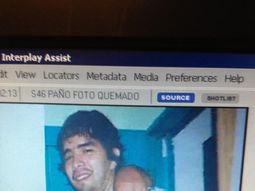 Está grave un joven al que prendieron fuego