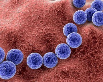 Streptococcus pyogenes: llegan a 487 los casos confirmados con 78 fallecimientos