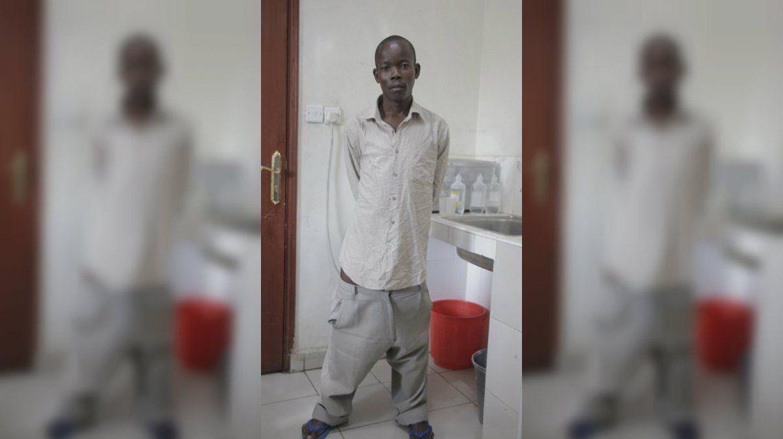 Nueva vida para un hombre que tenía un metro de pene y cinco kilos de